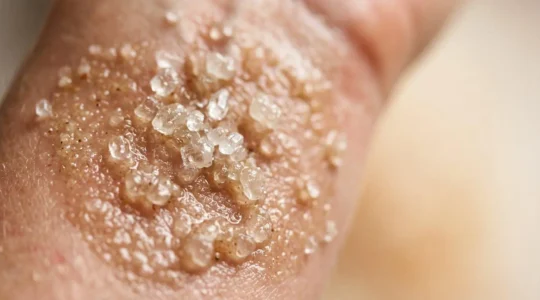 Gros plan sur une texture de gommage au sucre avec des grains cristallins sur une surface naturelle